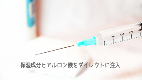 �q�A�������_����,�_�C���N�g�Ƀq�A�������_��͂�����̂ő�����������